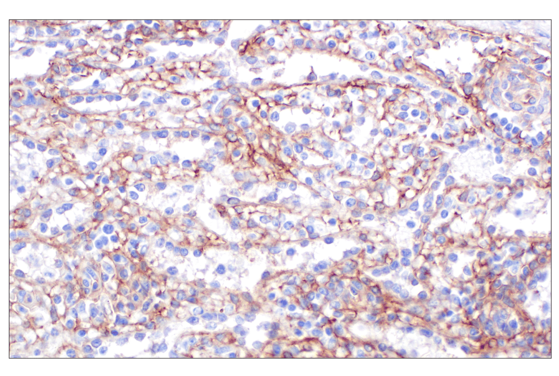 Immunohistochemistry Image 6: CD105/Endoglin (F9C5Q) Rabbit mAb