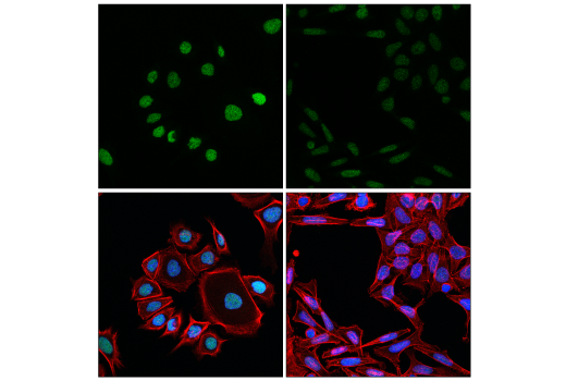 Immunofluorescence Image 2: PIAS1 (D33A7) XP<sup>®</sup> Rabbit mAb