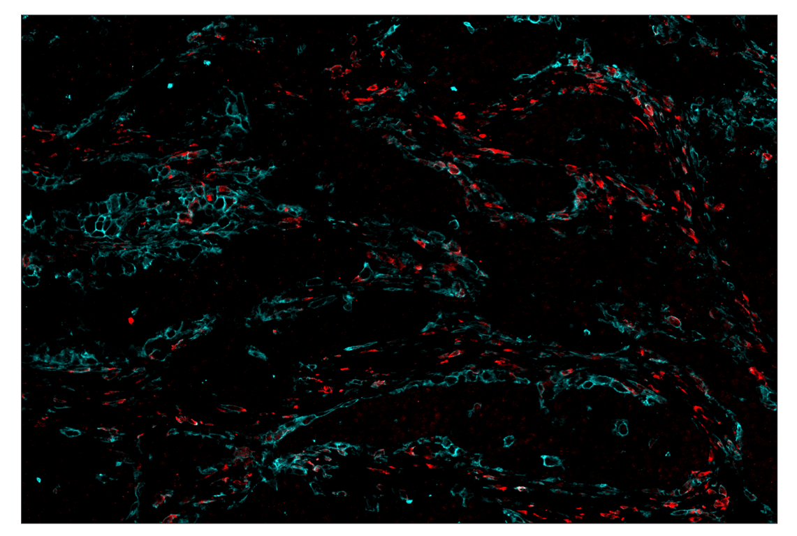 Immunohistochemistry Image 7: CD206/MRC1 (E2L9N) & CO-0035-594 SignalStar<sup>™</sup> Oligo-Antibody Pair