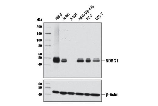 Western Blotting Image 1: NDRG1 (D8G9) XP<sup>®</sup> Rabbit mAb