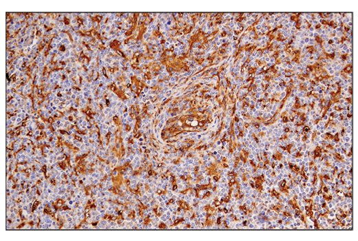 undefined Image 47: Late-Onset Alzheimer's Disease Risk Gene Antibody Sampler Kit