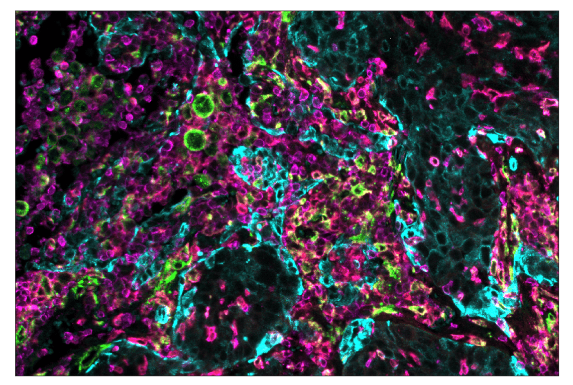 Immunohistochemistry Image 1: CD206/MRC1 (E2L9N) & CO-0035-594 SignalStar<sup>™</sup> Oligo-Antibody Pair