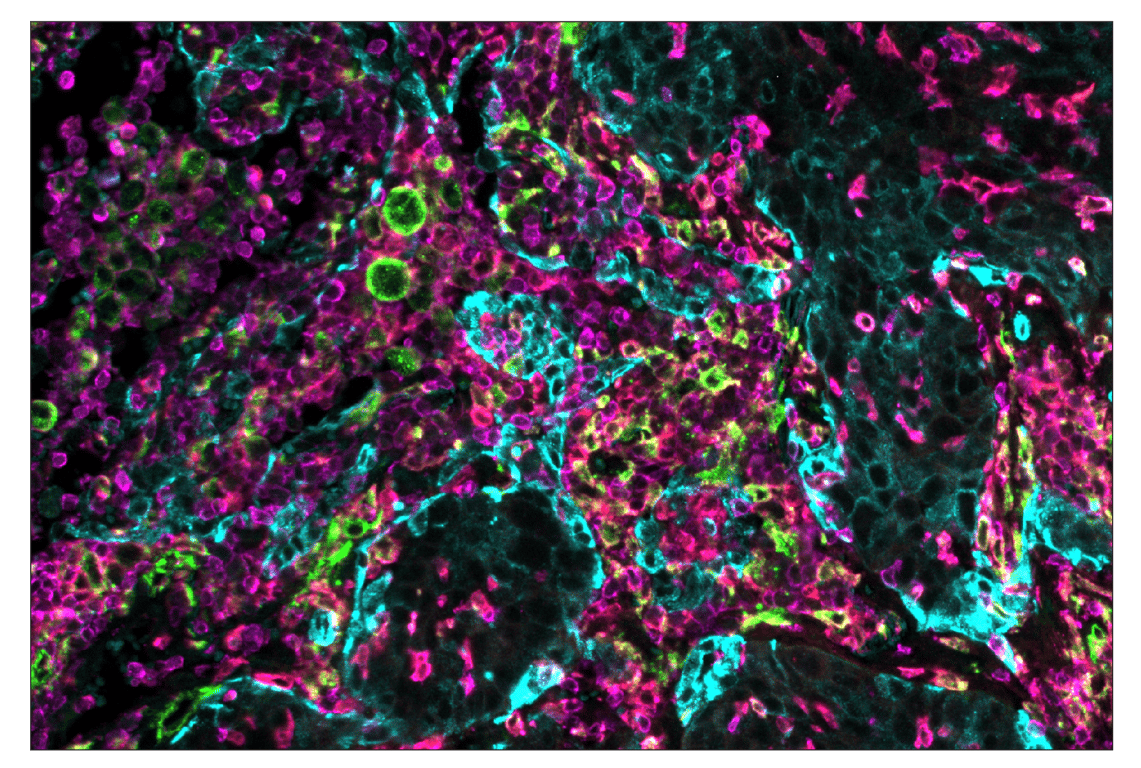 Immunohistochemistry Image 1: CD206/MRC1 (E2L9N) & CO-0035-647 SignalStar<sup>™</sup> Oligo-Antibody Pair