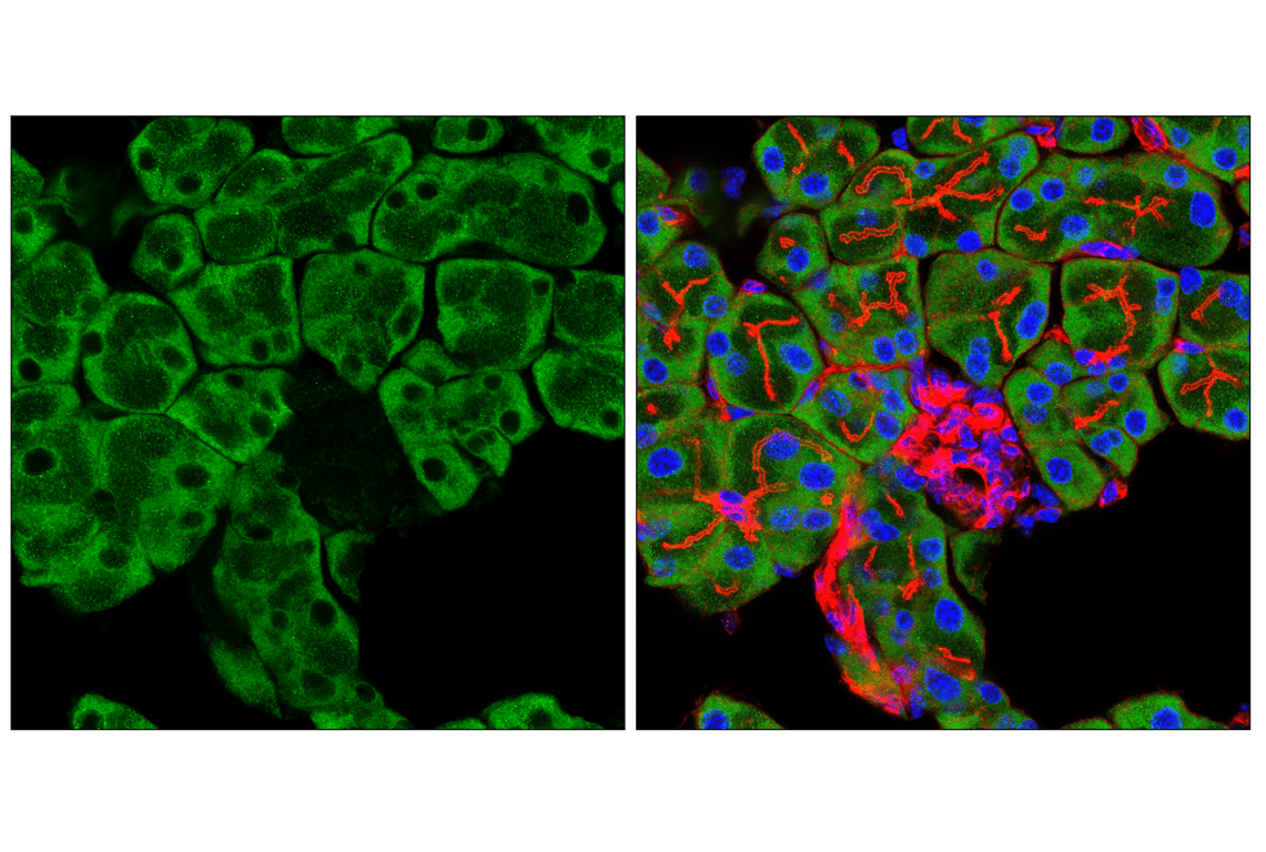 Immunofluorescence Image 2: UFL1 (F5P6L) Rabbit mAb