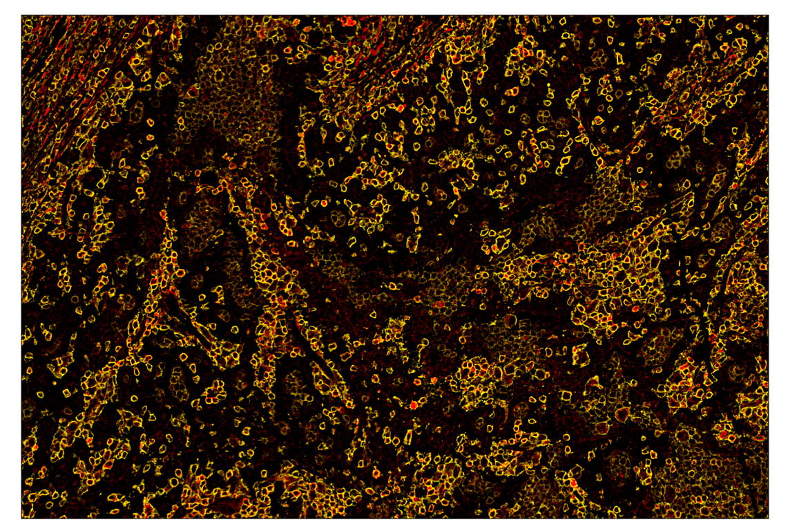 Immunohistochemistry Image 1: CD45 (Intracellular Domain) (D9M8I) & CO-0013-647 SignalStar<sup>™</sup> Oligo-Antibody Pair