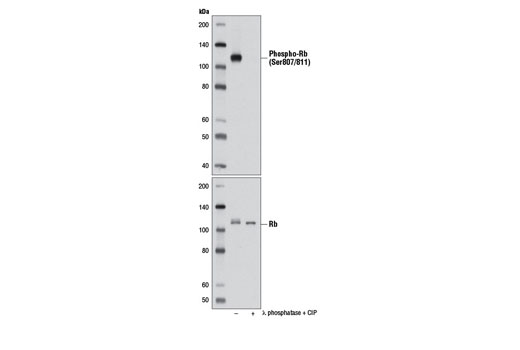 Western Blotting Image 1: Phospho-Rb (Ser807/811) (D20B12) XP<sup>®</sup> Rabbit mAb (BSA and Azide Free)