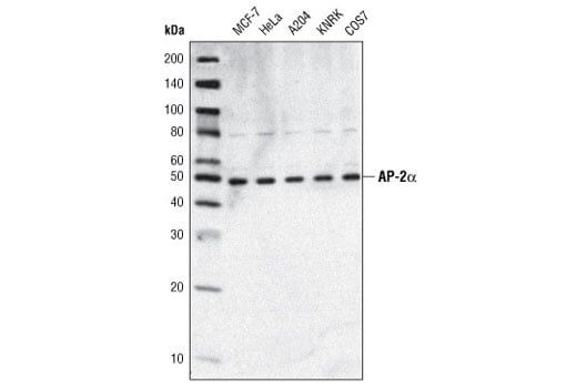 Western Blotting Image 1: AP-2α (C83E10) Rabbit mAb