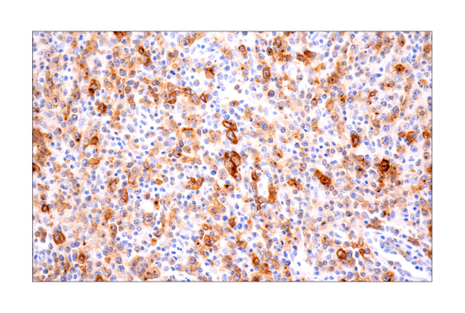 Immunohistochemistry Image 2: TNFRSF8/CD30 (E7E4D) XP<sup>®</sup> Rabbit mAb (BSA and Azide Free)