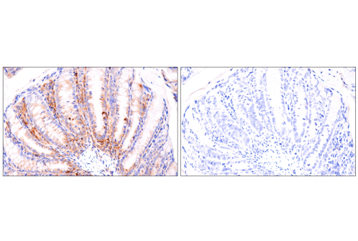 Immunohistochemistry Image 8: Cathepsin D (E7Z4L) XP<sup>®</sup> Rabbit mAb
