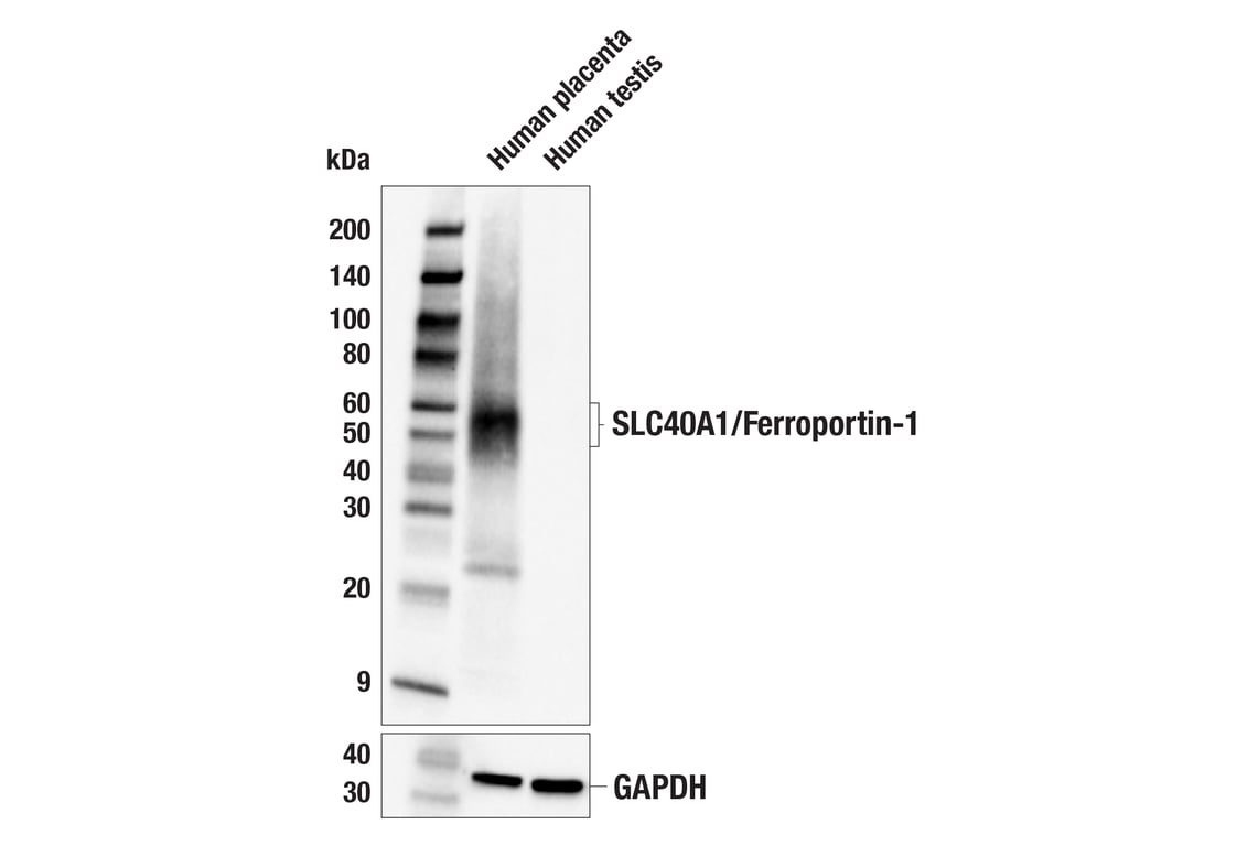 Western Blotting Image 2: SLC40A1/Ferroportin-1 (F9U5S) Rabbit mAb