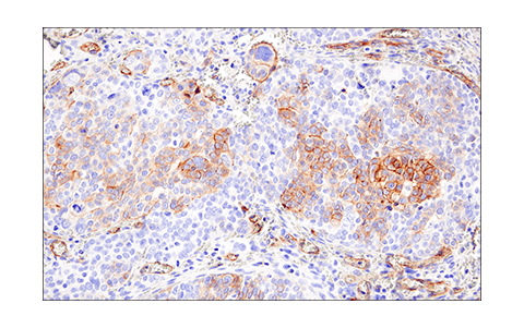 Immunohistochemistry Image 1: CD200 (E5I9V) XP<sup>®</sup> Rabbit mAb