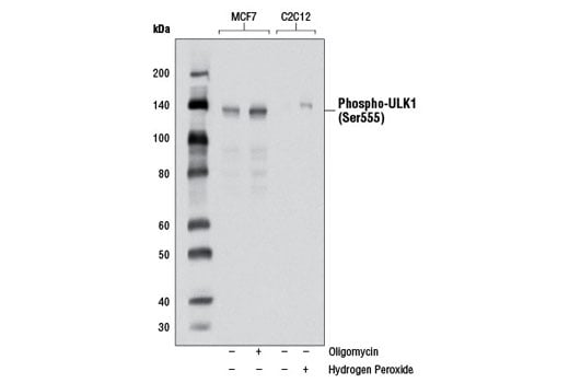 undefined Image 3: PhosphoPlus<sup>®</sup> ULK1 (Ser555) Antibody Duet