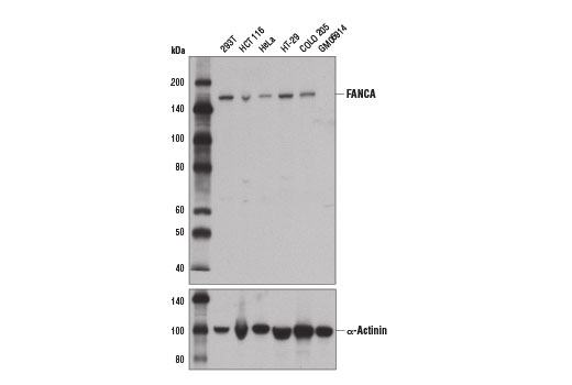 undefined Image 3: Fanconi Anemia Antibody Sampler Kit
