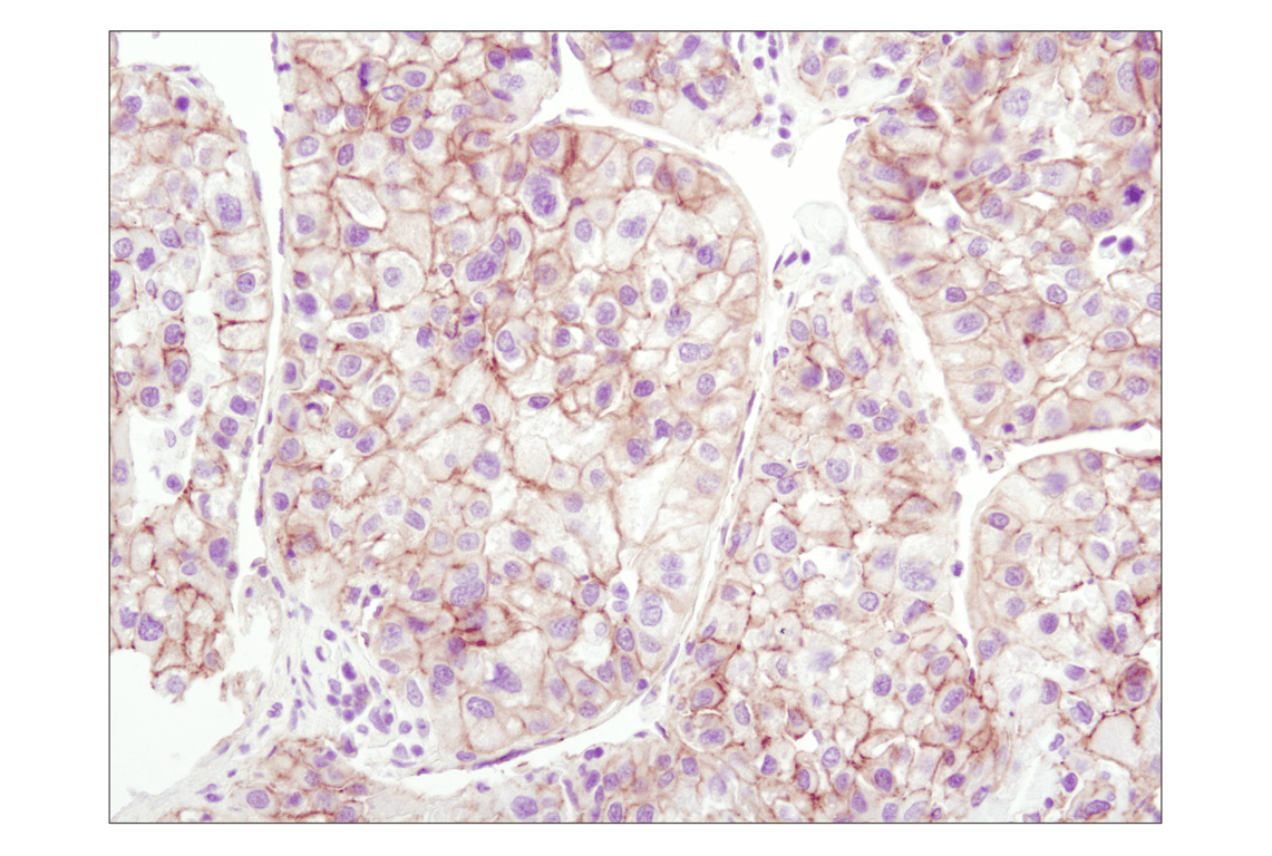 Immunohistochemistry Image 1: β-Catenin (6B3) Rabbit mAb