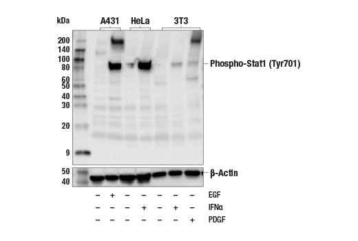 undefined Image 18: Human Reactive M1 vs M2 Macrophage IHC Antibody Sampler Kit