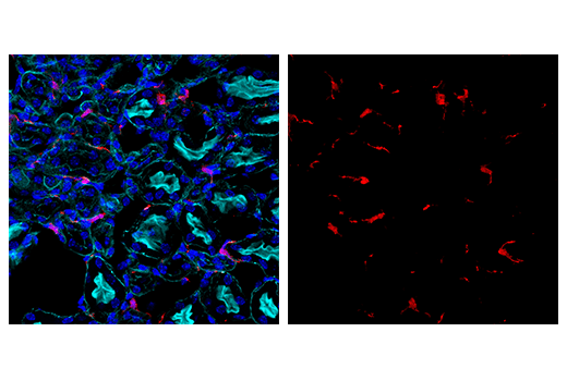 Immunofluorescence Image 2: Iba1/AIF-1 (E4O4W) XP<sup>®</sup>  Rabbit mAb (Alexa Fluor<sup>®</sup> 647 Conjugate)