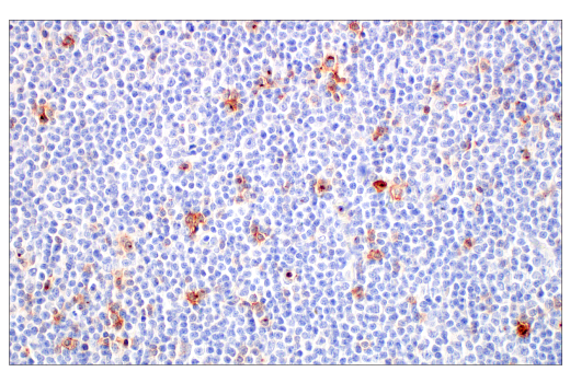 Immunohistochemistry Image 7: CD70 (E3Q1A) Rabbit mAb (BSA and Azide Free)