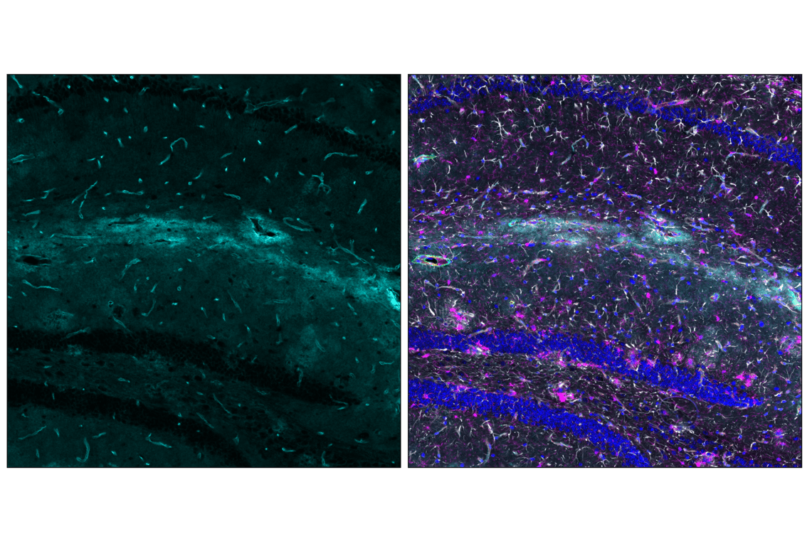 Immunofluorescence Image 5: AQP4 (D1F8E) XP<sup>®</sup> Rabbit mAb (Alexa Fluor<sup>®</sup> 647 Conjugate)