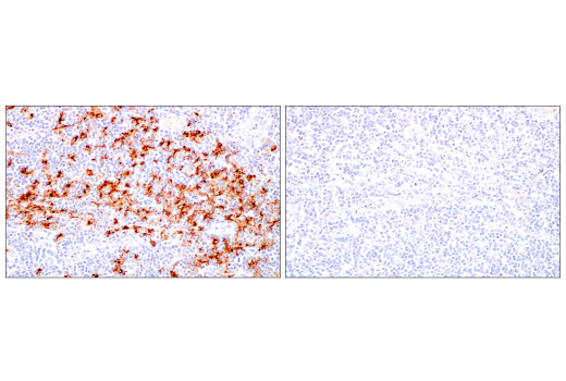 Immunohistochemistry Image 11: LAMP3/CD208 (E6E5U) XP<sup>®</sup> Rabbit mAb (BSA and Azide Free)