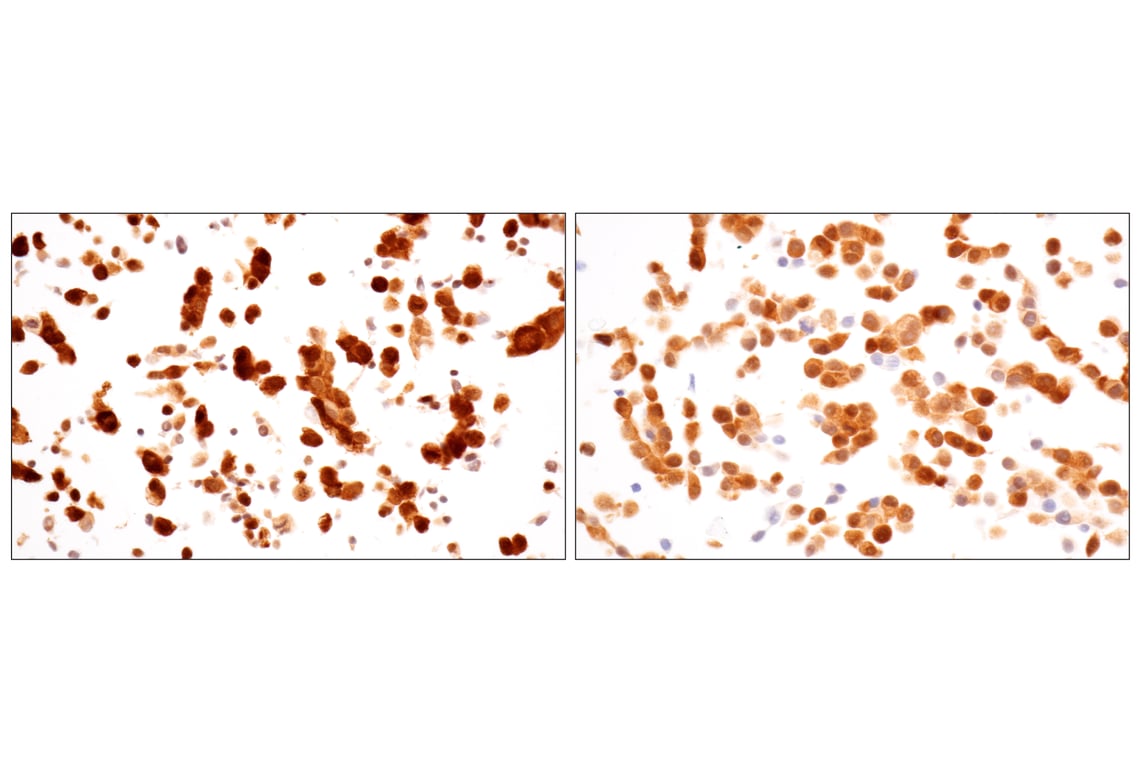 Immunohistochemistry Image 17: ACBP/DBI (E4V8V) XP<sup>®</sup> Rabbit mAb