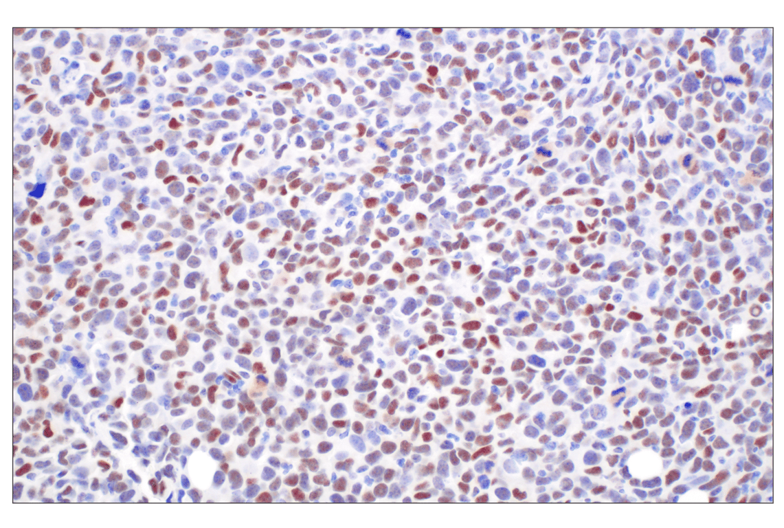 Immunohistochemistry Image 1: TCF4/ITF2 (E3X2Y) Rabbit mAb