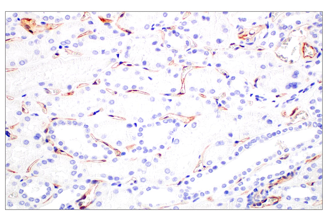 Immunohistochemistry Image 6: CD93/C1qR (E5H9B) Rabbit mAb (BSA and Azide Free)