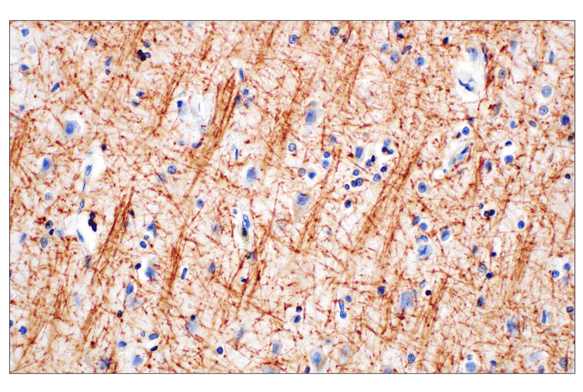 undefined Image 4: Demyelinating Disease Targets Antibody Sampler Kit