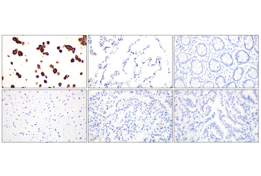 Immunohistochemistry Image 1: SARS-CoV-2 Nucleocapsid Protein (HL344) Rabbit mAb