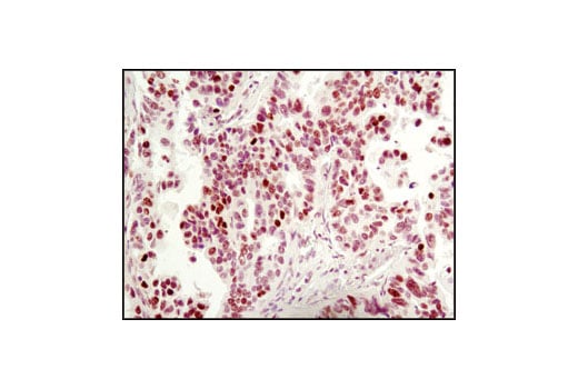 Immunohistochemistry Image 1: MeCP2 (D4F3) XP<sup>®</sup> Rabbit mAb