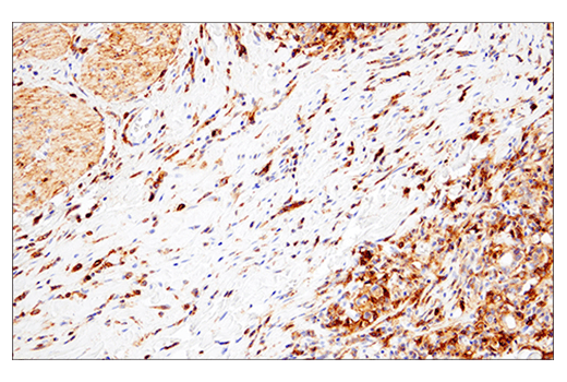 Immunohistochemistry Image 6: CD38 (E7Z8C) XP<sup>®</sup> Rabbit mAb