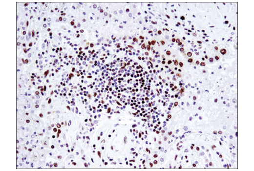 undefined Image 49: BAF Complex IHC Antibody Sampler Kit