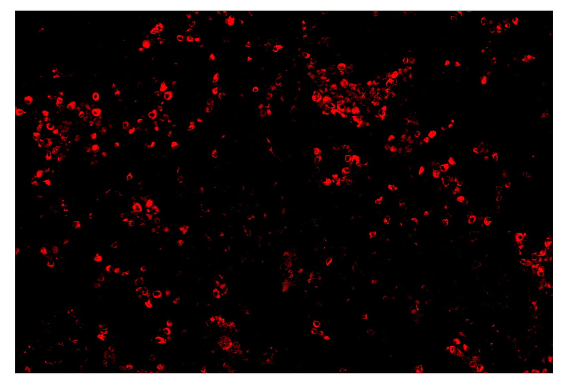 Immunohistochemistry Image 4: CD68 (D4B9C) & CO-0007-594 SignalStar<sup>™</sup> Oligo-Antibody Pair