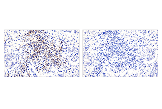 Immunohistochemistry Image 6: HPK1 (E1C3L) Rabbit mAb (BSA and Azide Free)