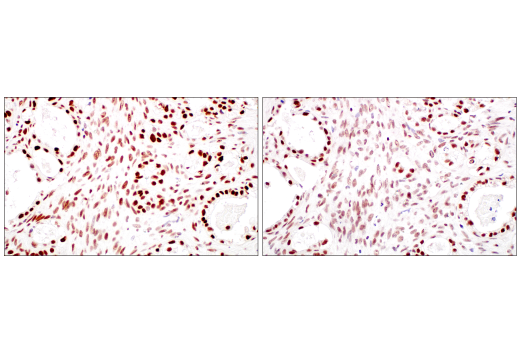Immunohistochemistry Image 10: METTL3 (E3F2A) Rabbit mAb (BSA and Azide Free)