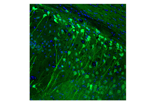 Immunofluorescence Image 1: UCHL1 (D3T2E) XP<sup>®</sup> Rabbit mAb