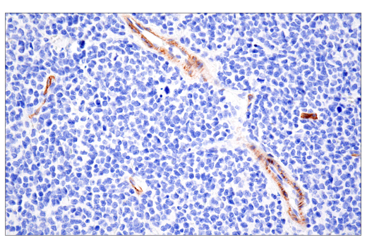 Immunohistochemistry Image 5: NG2/CSPG4 (E3B3G) XP<sup>®</sup> Rabbit mAb (BSA and Azide Free)