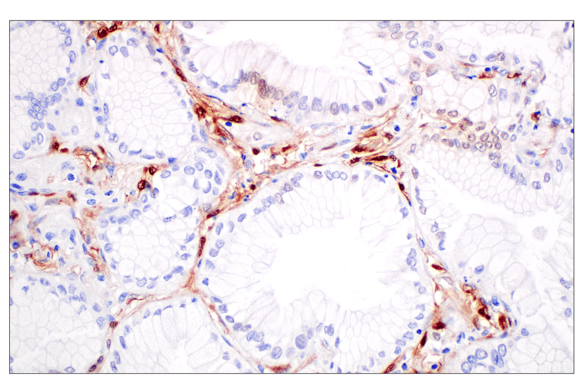 undefined Image 70: Cannabinoid Receptor 1 Downstream Signaling Antibody Sampler Kit