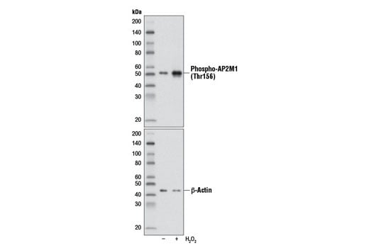 Western Blotting Image 1: Phospho-AP2M1 (Thr156) (D4F3) Rabbit mAb