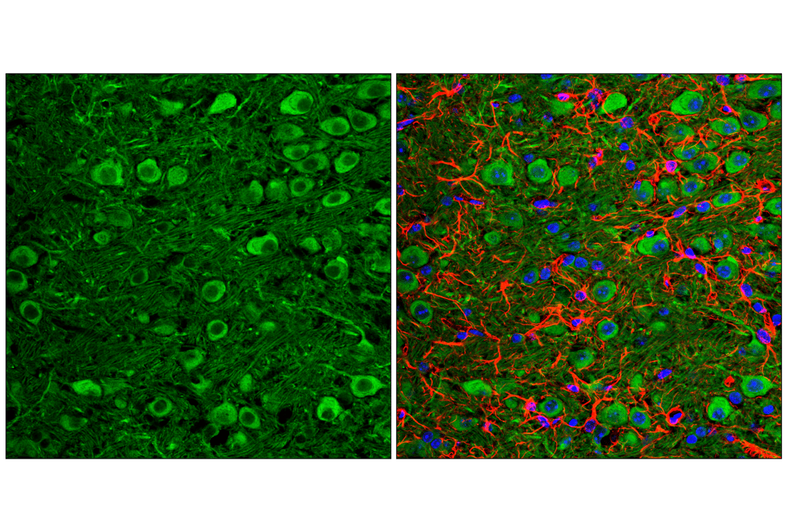 Immunofluorescence Image 2: LC3A/B (D3U4C) XP<sup>®</sup> Rabbit mAb (BSA and Azide Free)