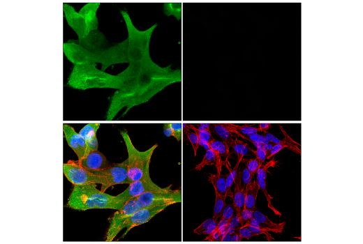 Immunofluorescence Image 1: Galectin-3/LGALS3 (E7B6R) Rabbit mAb