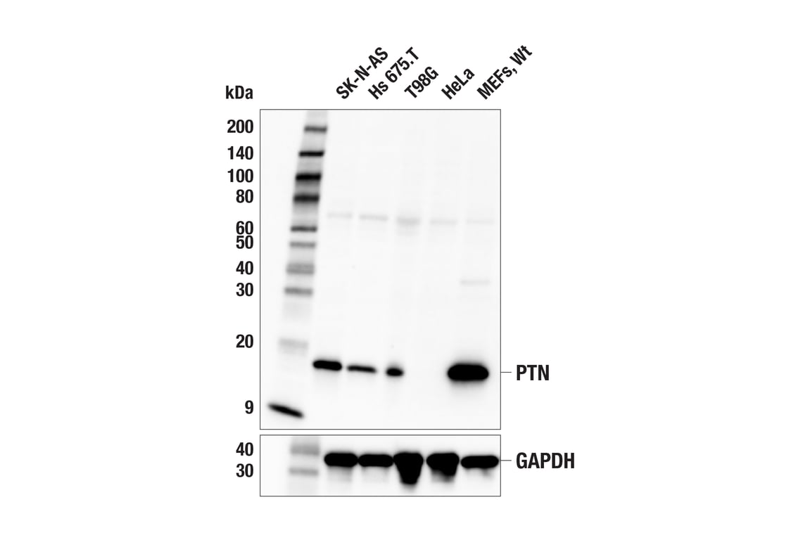 Western Blotting Image 1: PTN (F7T3F) Rabbit mAb