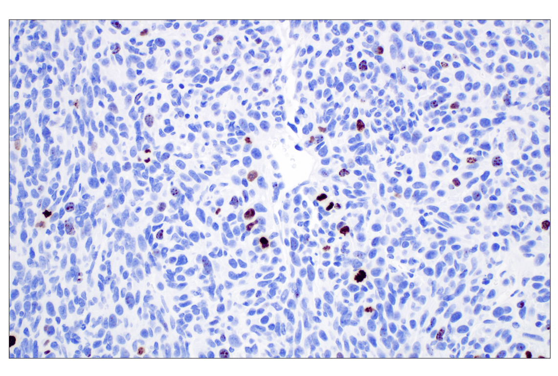 Immunohistochemistry Image 9: Phospho-Histone H3 (Ser10) (D7N8E) XP<sup>®</sup> Rabbit mAb (BSA and Azide Free)