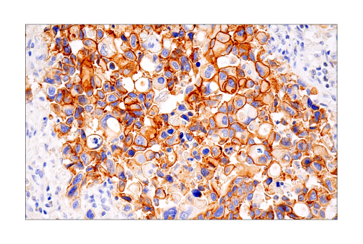 undefined Image 44: Lung Cancer RTK Antibody Sampler Kit