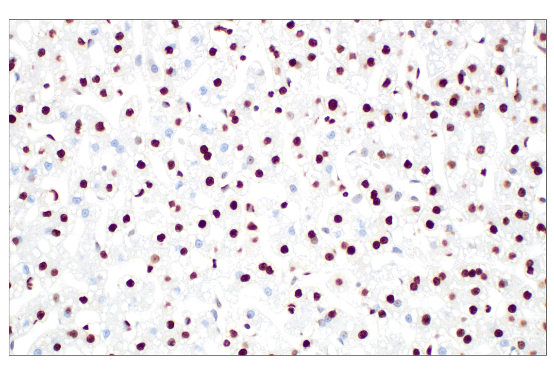 undefined Image 11: PhosphoPlus<sup>®</sup> Histone H3 (Ser10) Antibody Duet