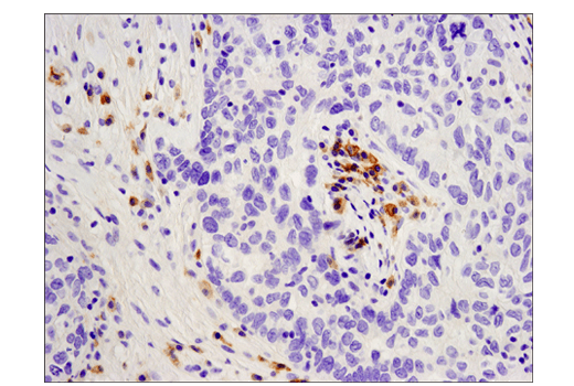 Immunohistochemistry Image 1: CD19 (Intracellular Domain) (D4V4B) XP<sup>®</sup> Rabbit mAb (BSA and Azide Free)