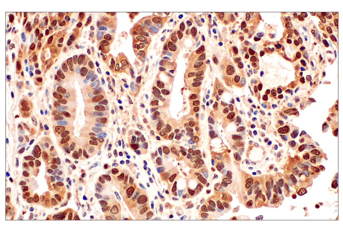 Immunohistochemistry Image 1: MTAP (E5R1I) Rabbit mAb (BSA and Azide Free)