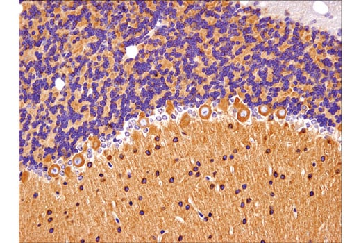 Immunohistochemistry Image 2: Huntingtin (D7F7) XP<sup>®</sup> Rabbit mAb