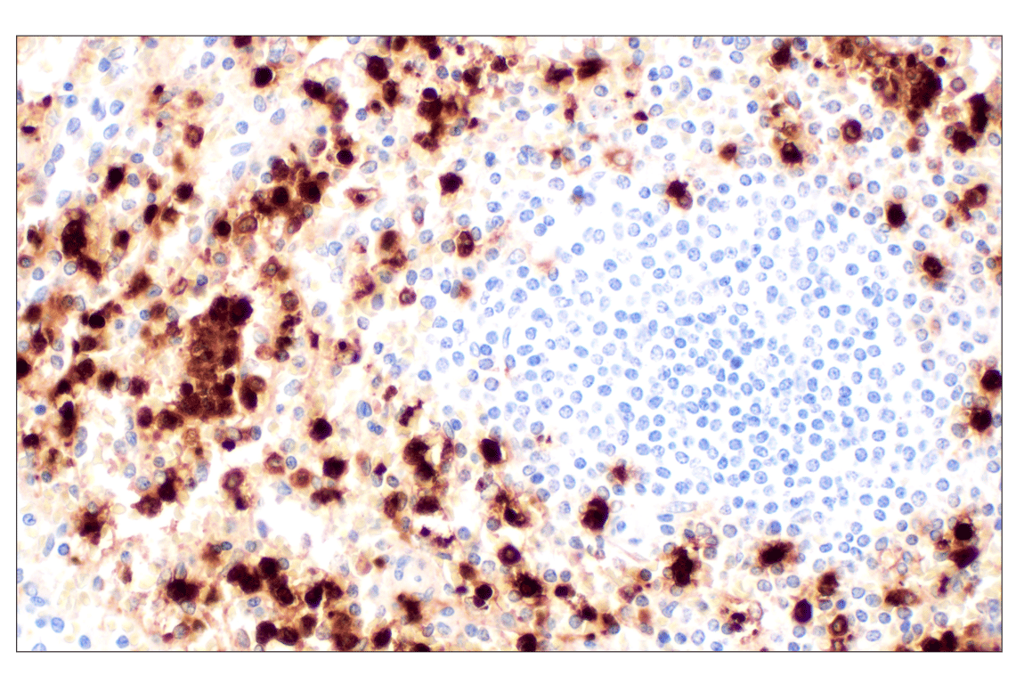 Immunohistochemistry Image 6: Neutrophil Elastase (F4H3X) Rabbit mAb (BSA and Azide Free)