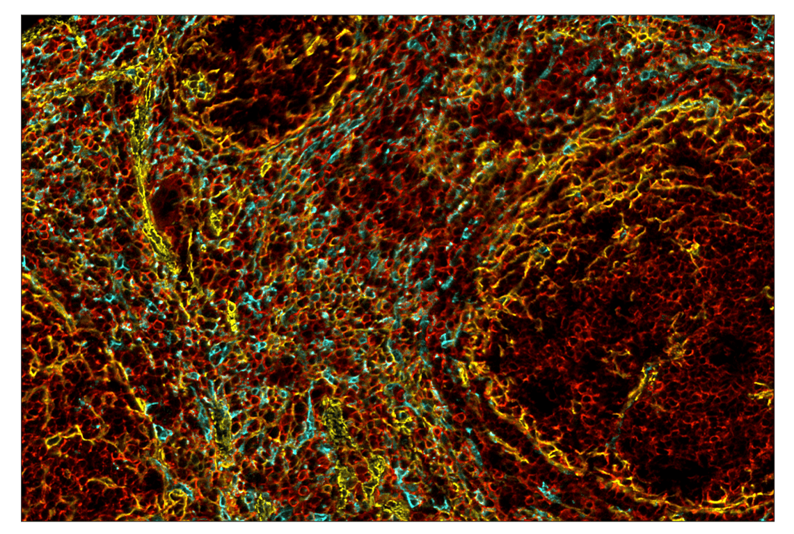 Immunohistochemistry Image 2: α-Smooth Muscle Actin (D4K9N) & CO-0024-594 SignalStar<sup>™</sup> Oligo-Antibody Pair