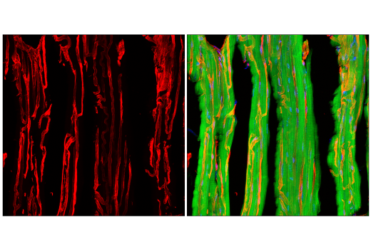 Immunofluorescence Image 3: Caveolin-1 (D46G3) XP<sup>®</sup> Rabbit mAb